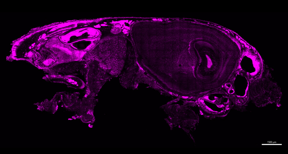 Confocal Skull image used to locate Cryptococcus invading the brain